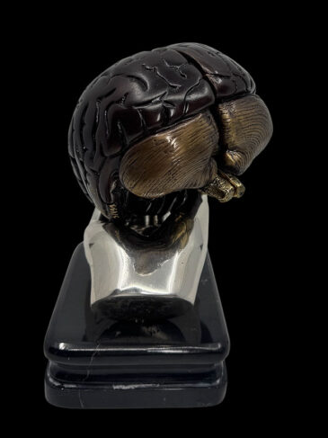brain in doctor‘s hand